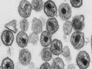 Bağırsak florasının cilt kanseriyle ilişkisi tespit edildi