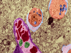 Bilim insanlarından uyarı: "Serbest yaşayan amipler" küresel sağlık tehdidi yaratıyor