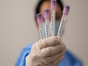 CDC, hantavirüs vakalarını “3'üncü seviye acil durum” kapsamında izlemeye aldı