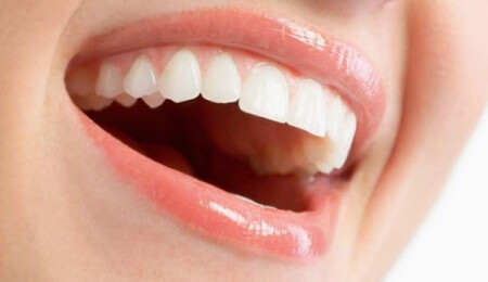 8 adımda ağız kokusundan kurtulun!