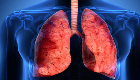 Akciğer Kanseri Tedavi Yöntemleri Nelerdir? Nasıl Teşhis Edilir?