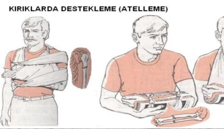 Baykal: "Kırık veya çıkık olduğunu nasıl anlayacağız?"