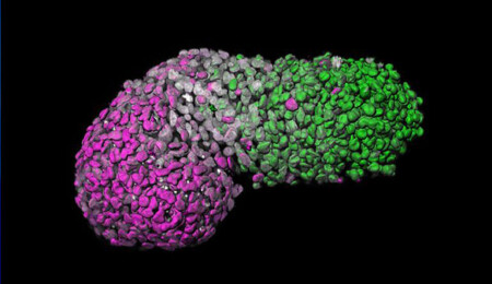 Güney Kıbrıs’ta embriyolar kayboluyor