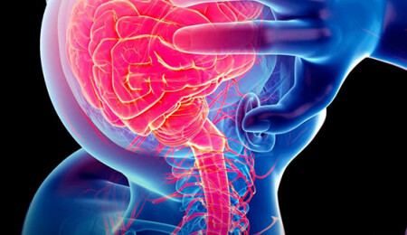 Epilepsi Nedir? Epilepsi İle Başa Çıkmanın 10 Doğal Yolu