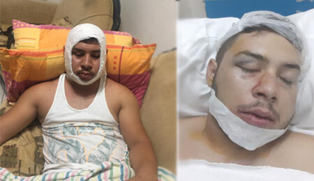 Kavgada çenesini kırdılar: "Bu eşkıyaların serbest kalma olasılığını hazmedemiyoruz"