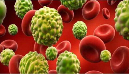 Küba'ın geliştirdiği kanser ilacı olumlu sonuçlar veriyor