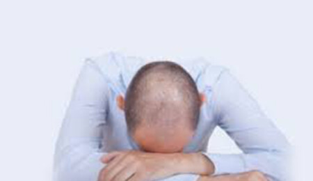 Kimler Saç Ekimi Yaptırabilir