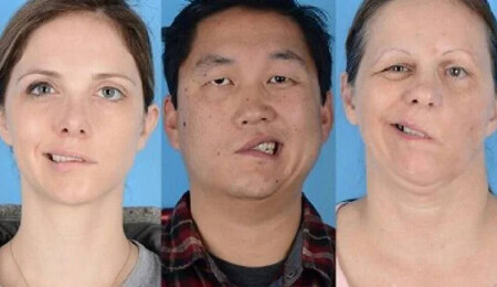 Koronavirüs aşısında beklenmedik yan etki