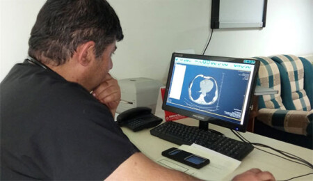 Lefkoşa Devlet Hastanesinde Uyku Laboratuarı" hizmete sokuldu