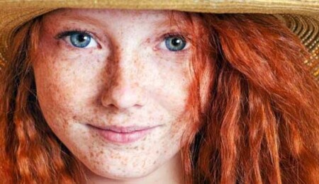 Güneş lekelerine karşı etkili çözümler