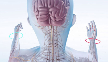 Multipl Skleroz (MS) Nedir? Nedenleri, Belirtileri ve Başa Çıkmanın Yolları