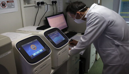 PCR testi ücreti 300 TL