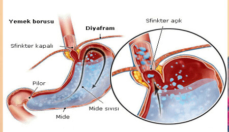 Yemek yedikten sonraki öksürüğe dikkat