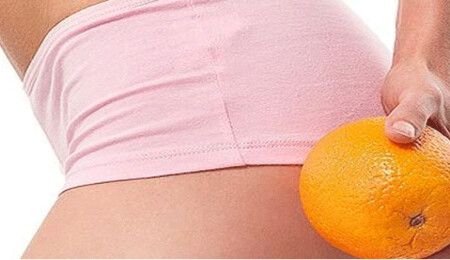 Selülitten kurtulmanın yolları