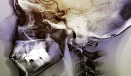 Beynin sigara tiryakiliğiyle bağlantılı kısmı bulundu