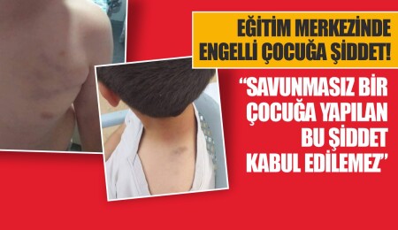 Bir eğitim merkezinde, engelli çocuğa şiddet uygulandı!