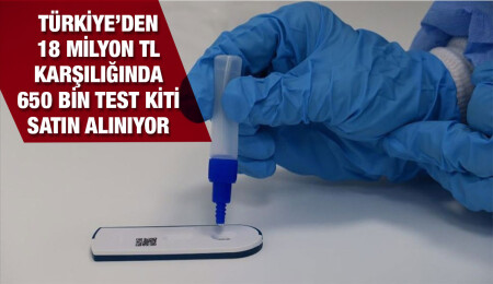 Hükümet, 18 milyon TL karşılığında Türkiye’den 650 bin test kiti satın alıyor