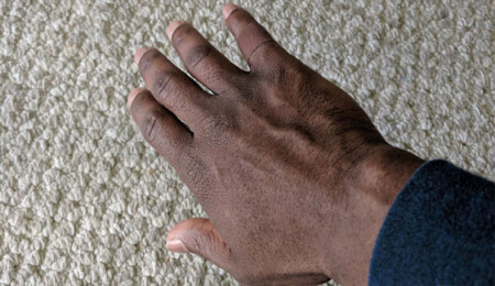 Ten rengine uygun yara bandı buldu: "Gözyaşlarımı zor tutuyorum"