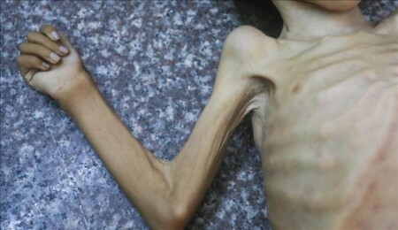 İsrail'in kıtlığı dayattığı Gazze'de son 24 saatte 7 kişi daha açlıktan hayatını kaybetti