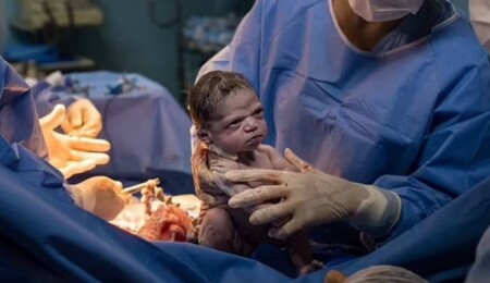 Doğar doğmaz kaşlarını çatan bebek şimdi üç yaşında ve sinirleri yatışmış