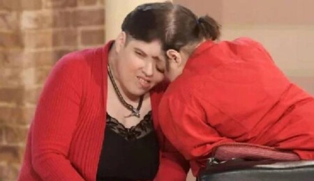 Dünyanın en yaşlı yapışık ikizleri 62 yaşında hayata veda etti