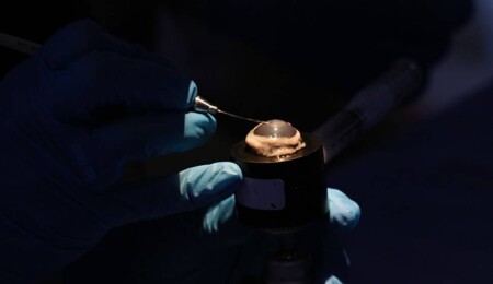 Ekran izleme süresinin uzaması göz kuruluğu ve şaşılık riskini artırıyor