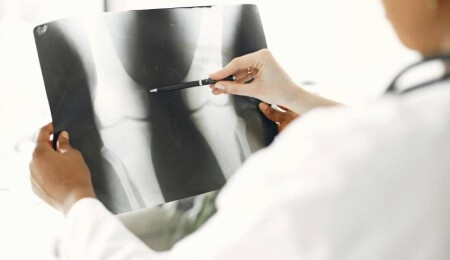 Işığa maruz kalınca kemiği iyileştiren malzeme üretildi