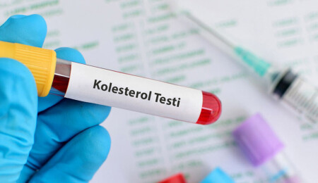 Kolesterolü doğal olarak düşüren 5 etkili besin