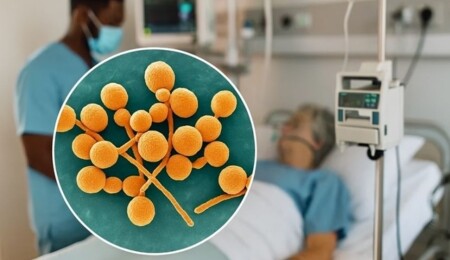 Yayılımı Avrupa’da endişe yaratan “candida auris” Güney Kıbrıs’ta da görüldü