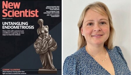 Kıbrıslı Türk biliminsanı Nilüfer Rahmioğlu'nun çalışması New Scientist dergisine kapak oldu