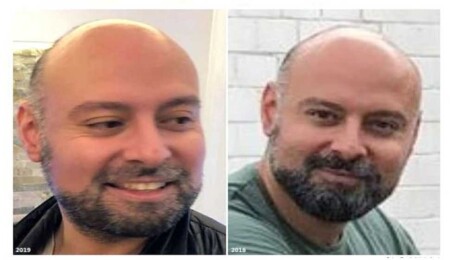 Interpol 45 milyon euro ile kaçan Türk vatandaşını arıyor