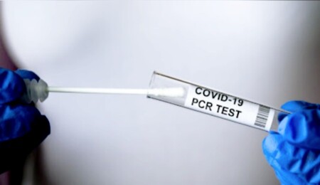 56 yaşındaki lösemi hastasının 84. koronavirüs testi de pozitif çıktı