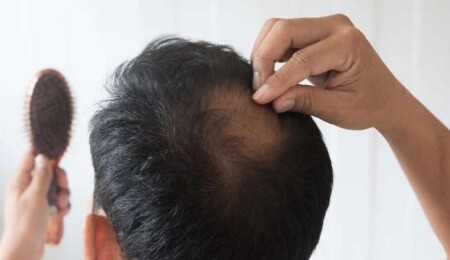 Sağlıklı ve gür saçlar için beslenme tüyoları