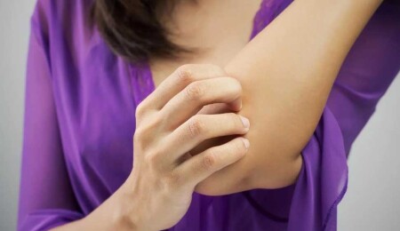 Sedef kontrol edilebilir bir hastalık