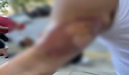 12 gündür maaşını alamayan Koop Süt çalışanı iş kazası geçirdi: Tazminatının kaldırılması isteniyor