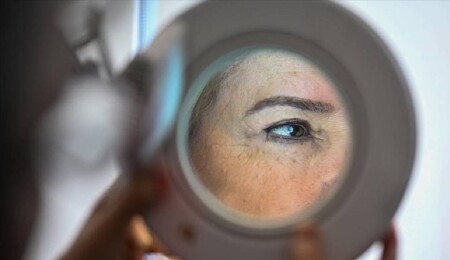 Araştırma: Kanser türlerinden melanom, cinsiyete göre vücudun farklı bölgelerinde yaygın