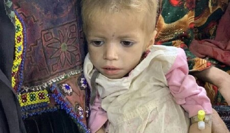 UNICEF, Afganistan'da 3,7 milyon çocuğun yetersiz beslenme nedeniyle acı çektiğini bildirdi