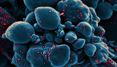 Hafif atlatanlarda bile görülüyor: İşte koronavirüsün tetiklediği tüm hastalıklar