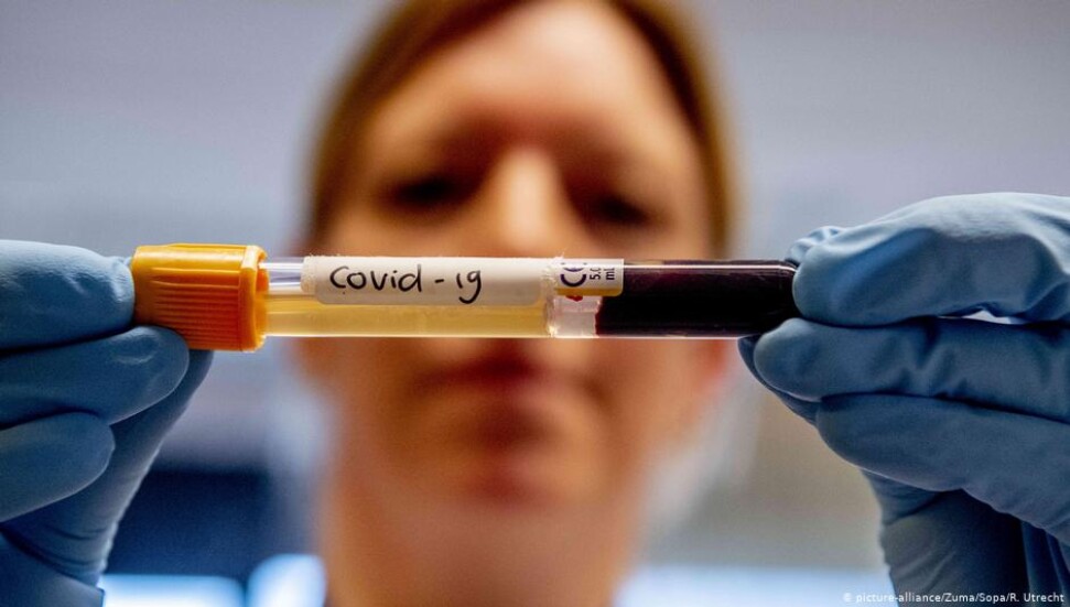 Güney Kore’deki araştırma sonucu: Covid-19 insanlara iki kere bulaşmaz