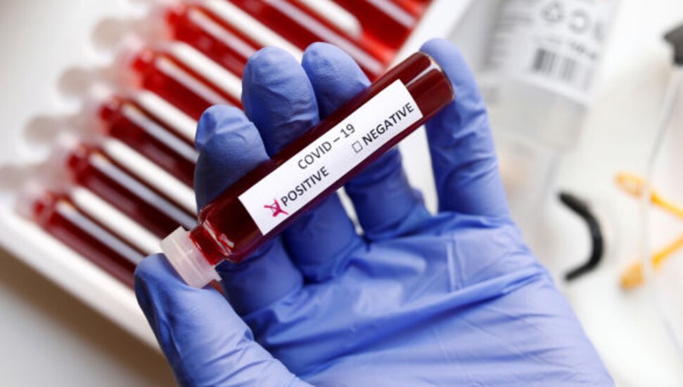 Türkiye'de illere göre haftalık koronavirüs vaka sayıları açıklandı