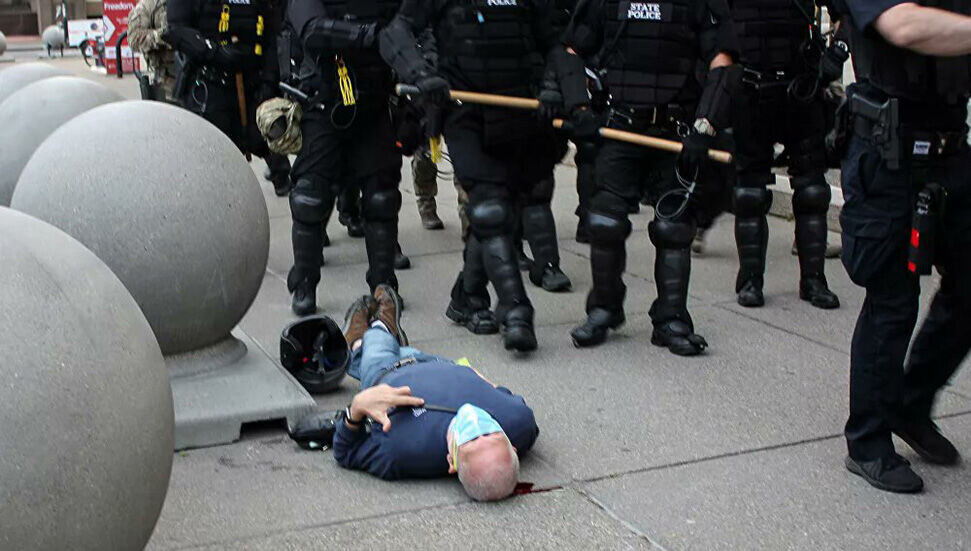 ABD'de polis saldırmıştı: Yaşlı adamın kafatası çatlak ve yürüyemiyor