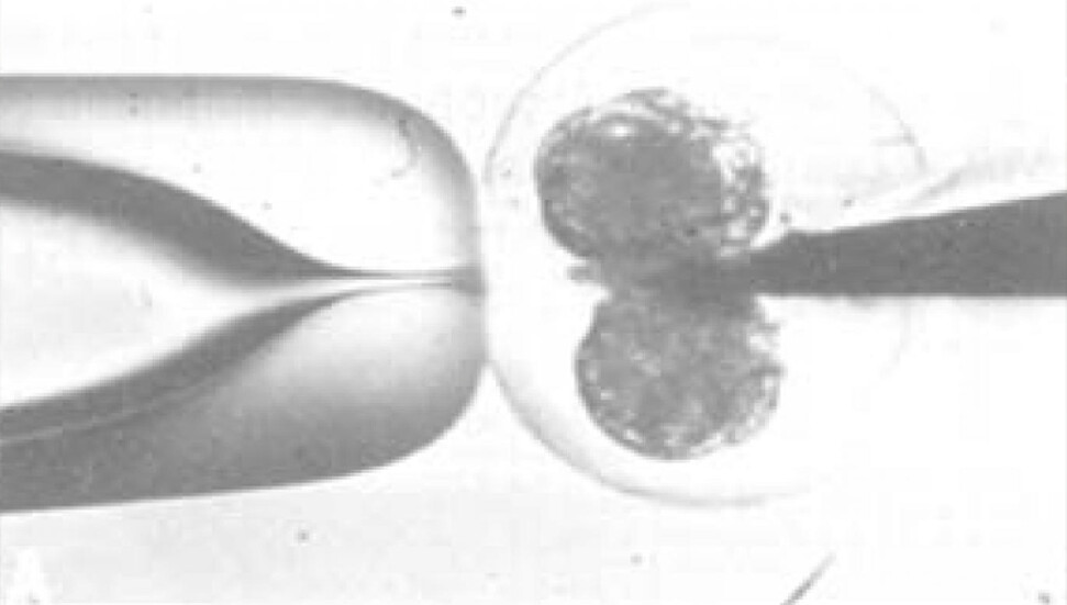 Dünyada ilk kez "3 ebeveynli bebek" doğdu