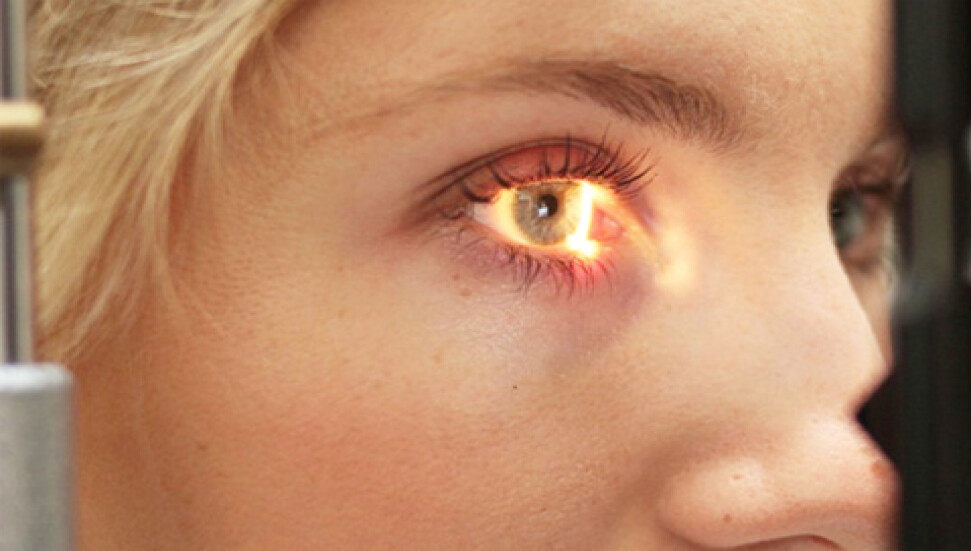 Diabetik Retinopatide ve Lazer Tedavisi