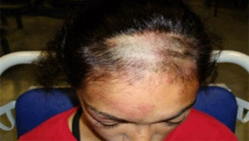 İngiltere'de 13 yaşındaki Türk kızına ırkçı saldırı