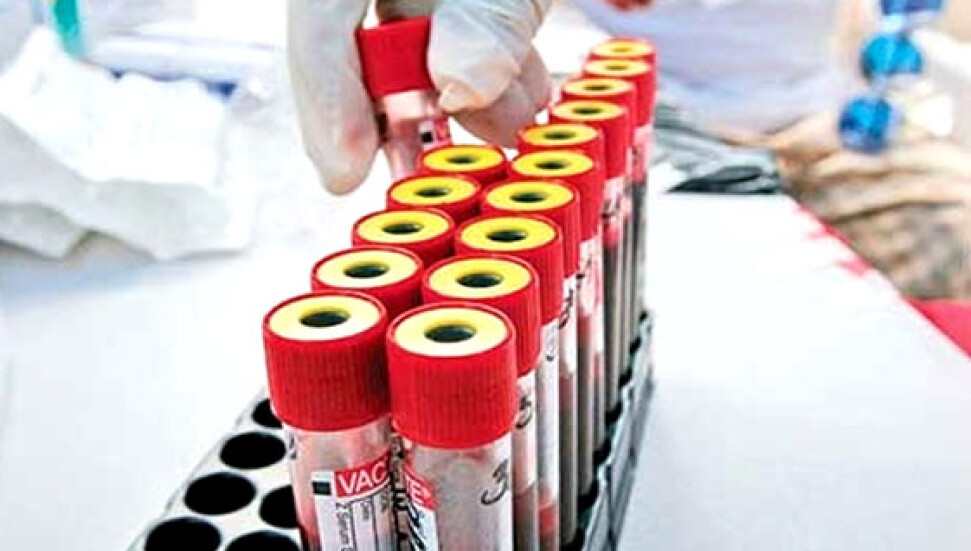 Hangi kan grubu daha şanslı?