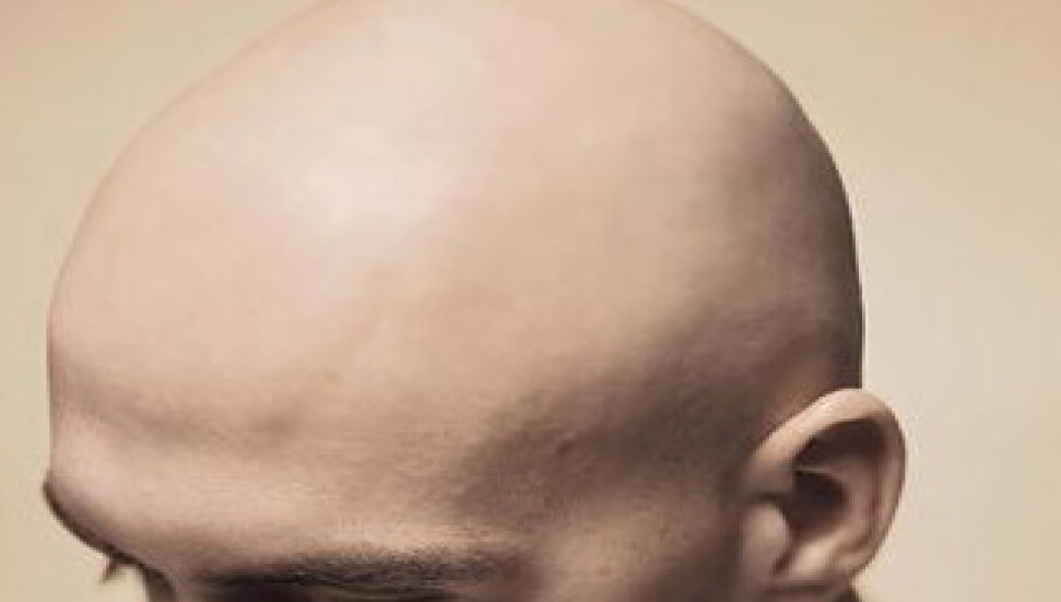 Kel kalmak istemiyorsanız dişlerinize iyi bakın!