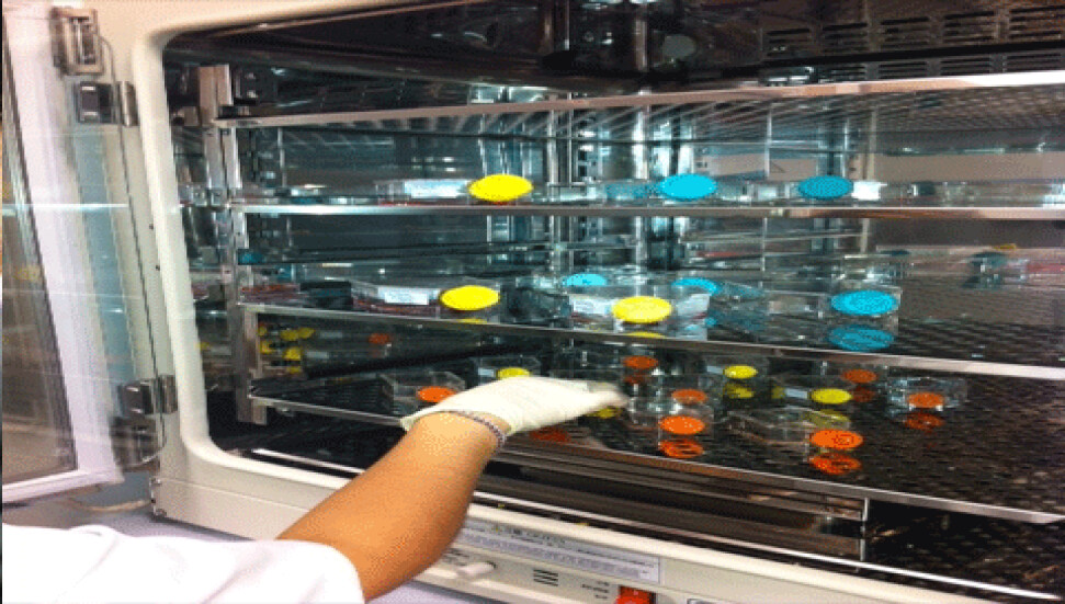 YDÜ Hastanesi Kordon Kanı Kök Hücre Nakil Merkezi ve Organ Nakli Merkezi Türkiye basınında