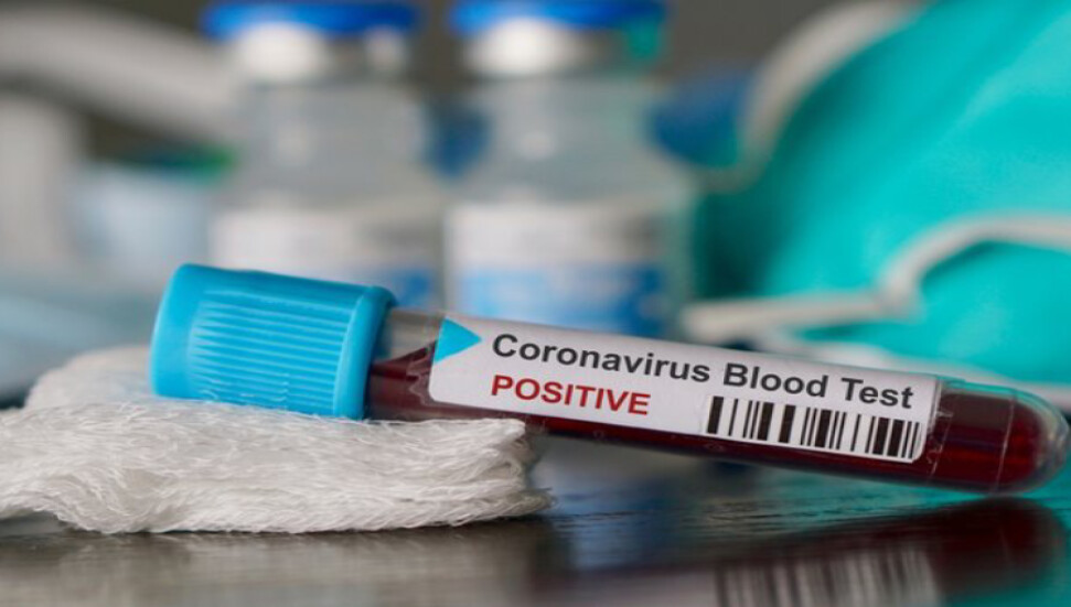 "Yoğun bakımdaki 3 hastadan 1'i KKTC vatandaşı"