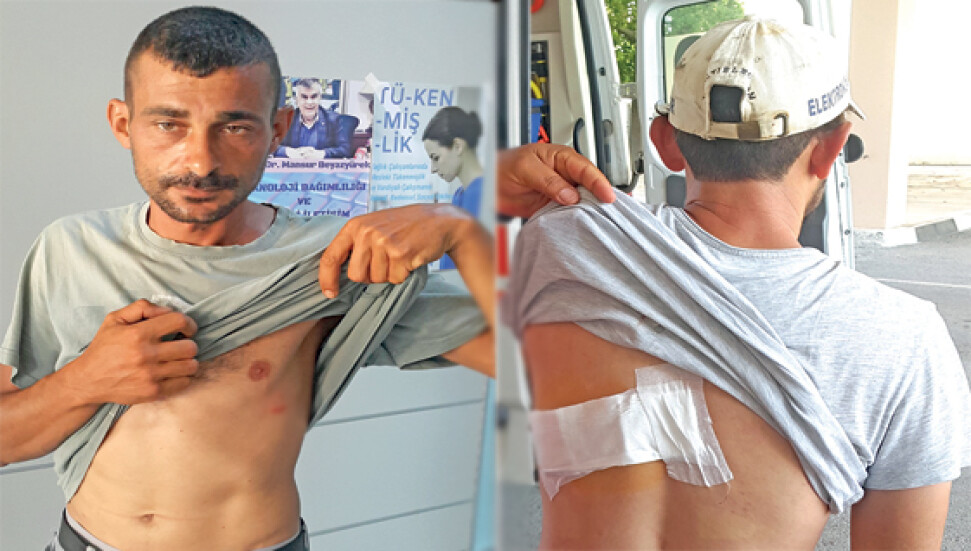 Rottweiler cinsi köpek 2 kişiyi ısırdı