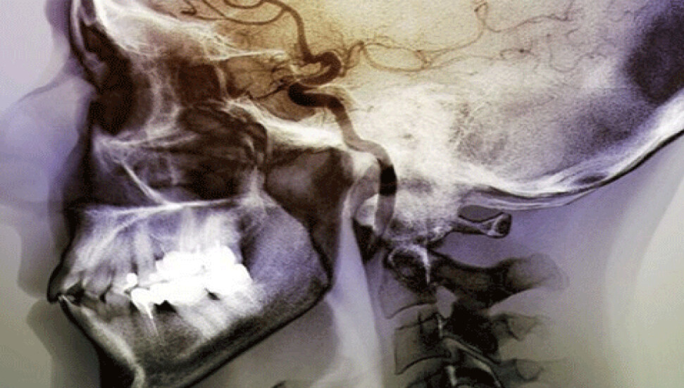 Beynin sigara tiryakiliğiyle bağlantılı kısmı bulundu